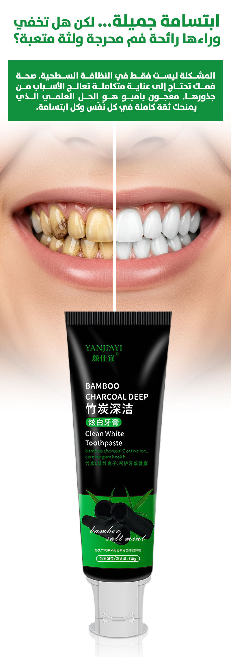 🔥 الأكثر طلباً ⭐️ معجون أسنان YANJIMI لتبييض وتنظيف عميق
